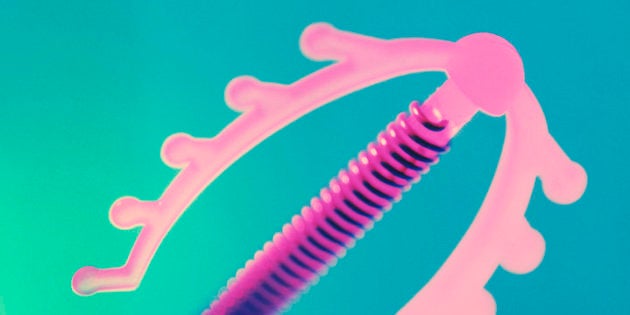 El Diu Como Metodo Anticonceptivo Dr Joan Matas Dalmases