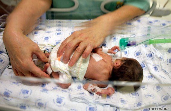5 Cosas Que No Deberias Decir A Los Padres De Un Bebe Prematuro El Huffpost Tendencias