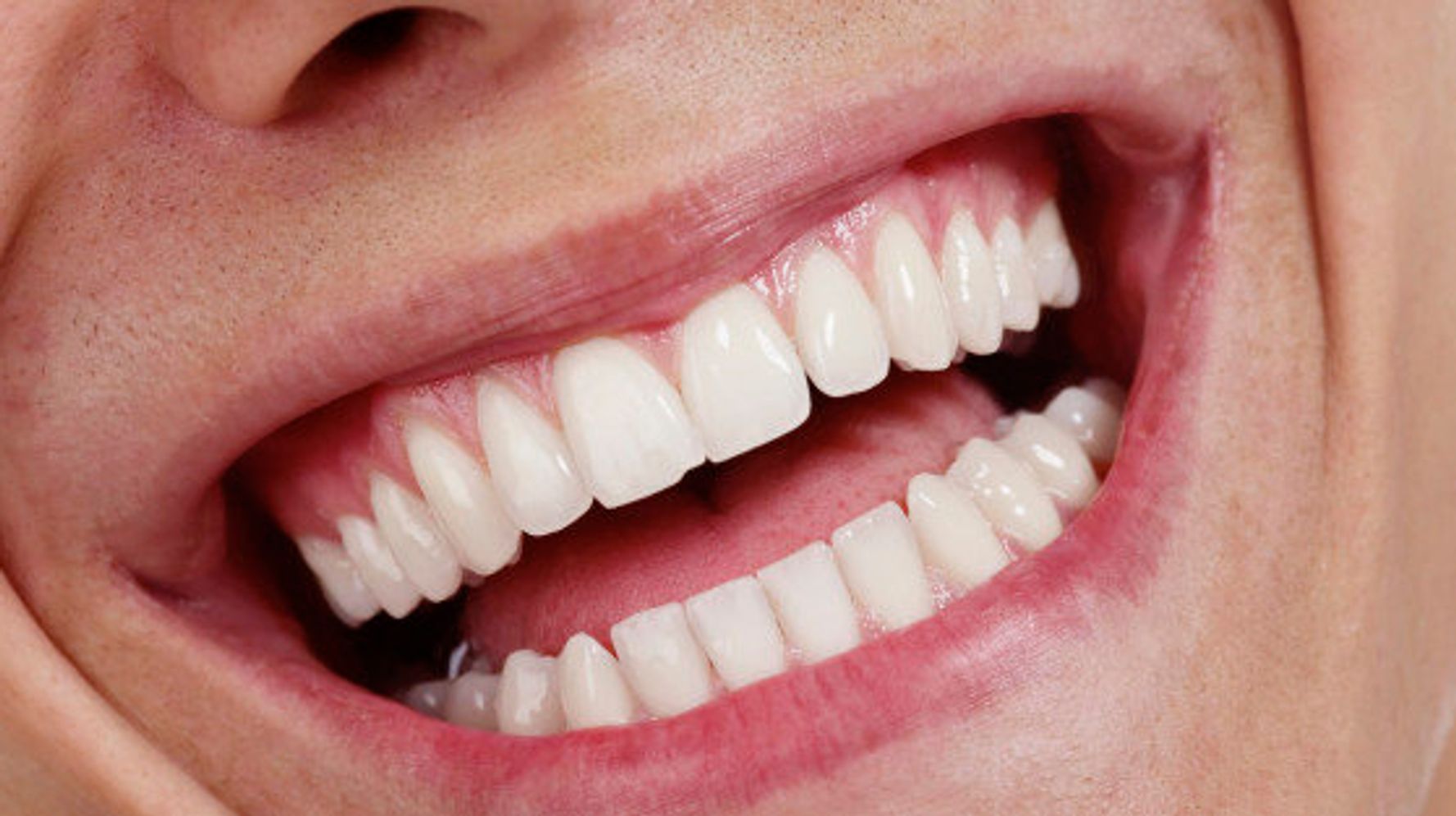картинки хороших зубов
