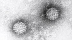 ¿Por qué la prevención es clave contra el Virus del Papiloma