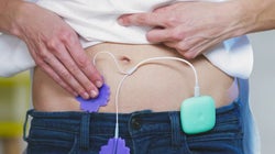 Un regla sin dolor, ¿es