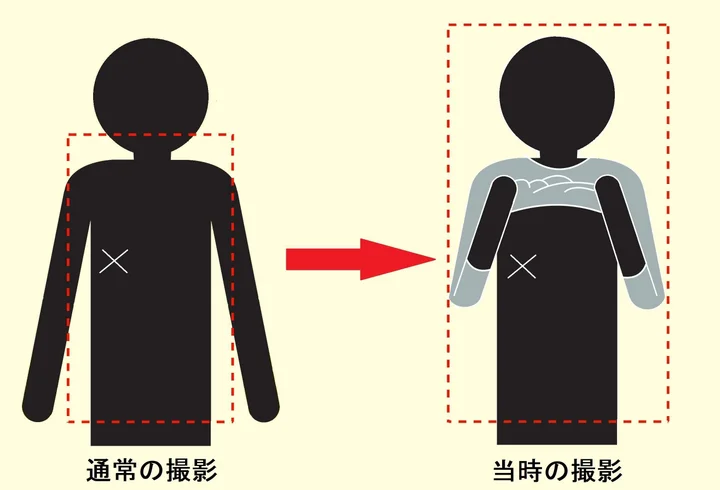 乳腺外科医が準強制わいせつに問われた公判 無罪判決を臨床の医師たちはどう見たか ハフポスト