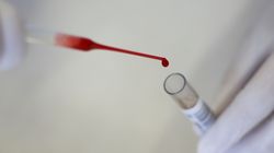 Un nouveau test sanguin permettrait de détecter le cancer de manière