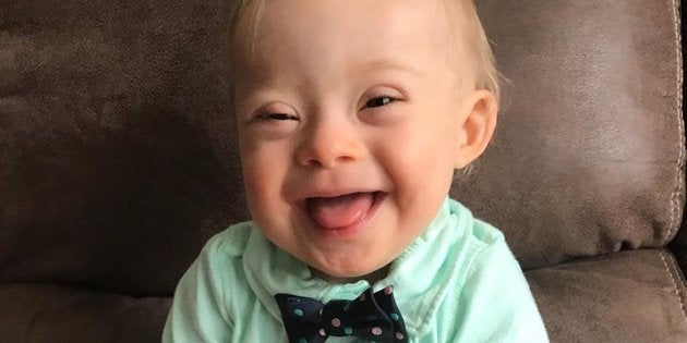 Ce Bebe Atteint De Trisomie Devient L Egerie D Une Celebre Marque De Petits Pots Une Premiere Le Huffington Post Life