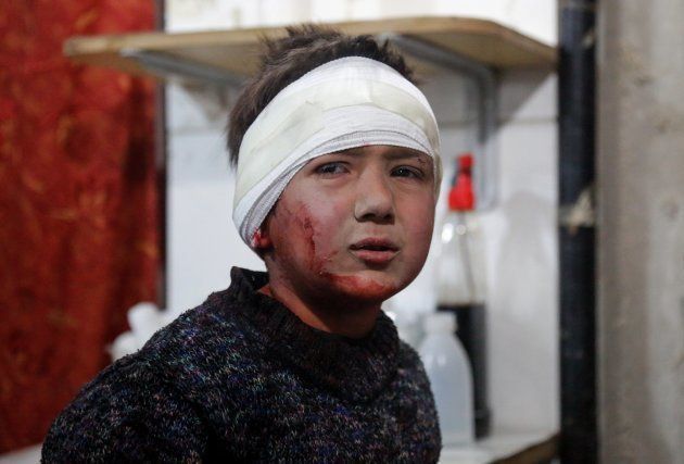 Dans la Ghouta orientale en Syrie, 18 cas de suffocation rapportés, l'utilisation d'armes chimiques