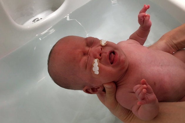 Au Japon Ce Bebe Premature Est Ne En Pesant 268 Grammes Le Huffington Post Life