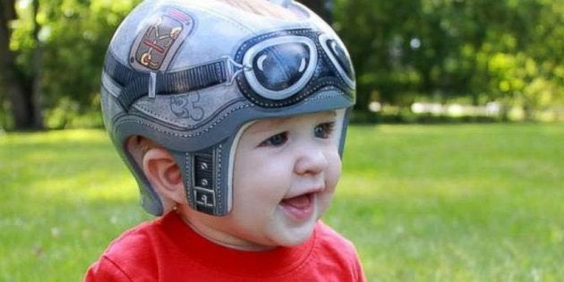 Les Medecins De Ce Bebe Atteint De Plagiocephalie Ont Fait Une Suggestion Geniale A Ses Parents Le Huffpost