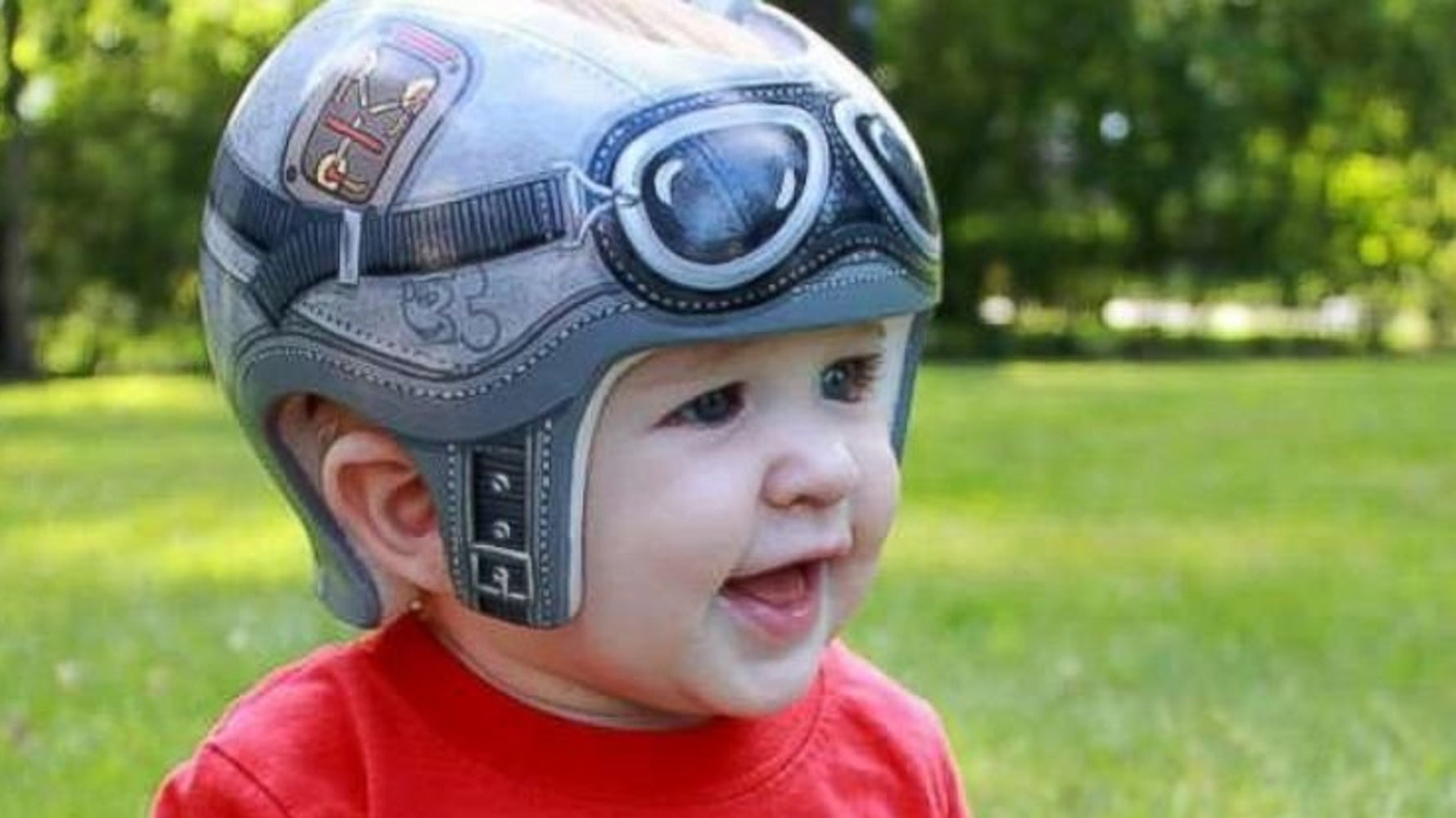 Les Medecins De Ce Bebe Atteint De Plagiocephalie Ont Fait Une Suggestion Geniale A Ses Parents Le Huffpost