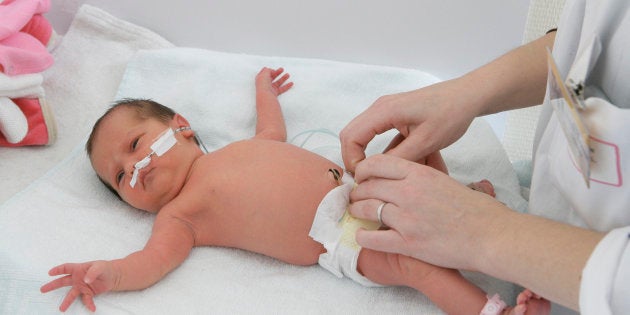 Un Couple Autorise A Conserver Le Sang Du Cordon Ombilical De Son Bebe Une Premiere En France Le Huffington Post Life