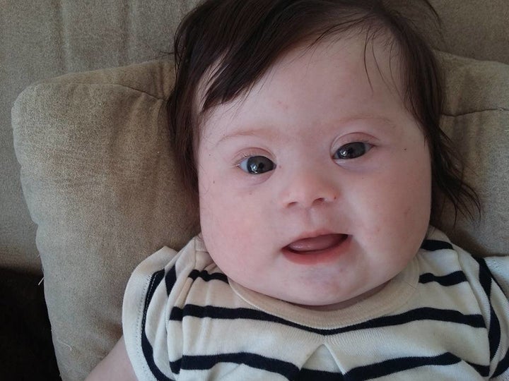 Louise Ma Fille Quatre Mois Deux Bras Deux Jambes Et Un Chromosome En Plus Le Huffington Post Life Louise Ma Fille Quatre Mois Deux Bras Deux Jambes Et Un Chromosome En Plus Le Huffington Post Life