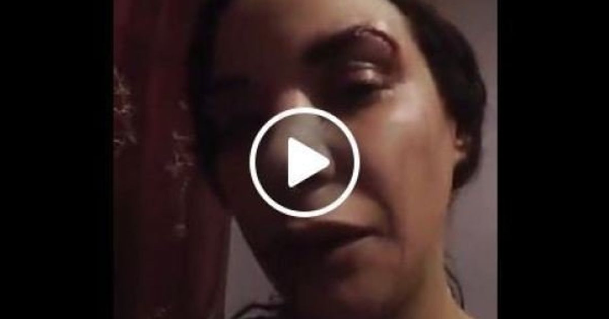 VidÉo Lactrice Loubna Abidar De Much Loved Victime Dune Agression Au Maroc Le Huffpost 0666