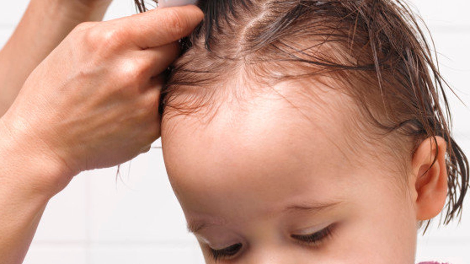 Remede Contre Les Poux N Utilisez Pas De Produits Veterinaires Sur Les Enfants Met En Garde L Anses Le Huffington Post Life