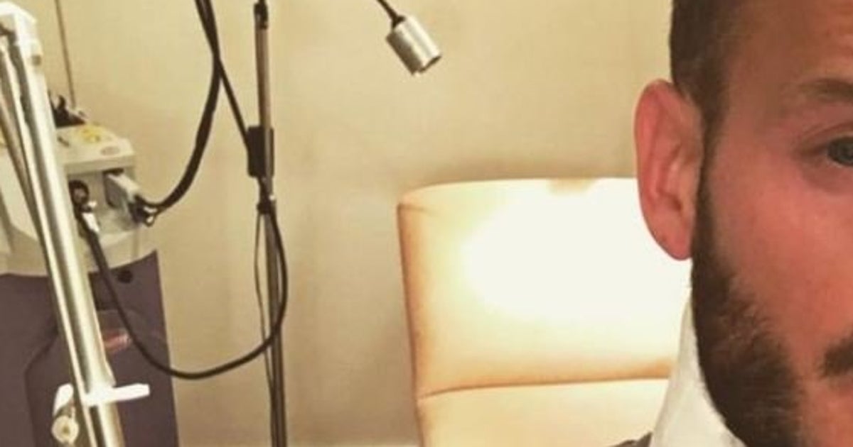 Photo Matt Pokora Se Fait Enlever Son Tatouage Sur Le Cou