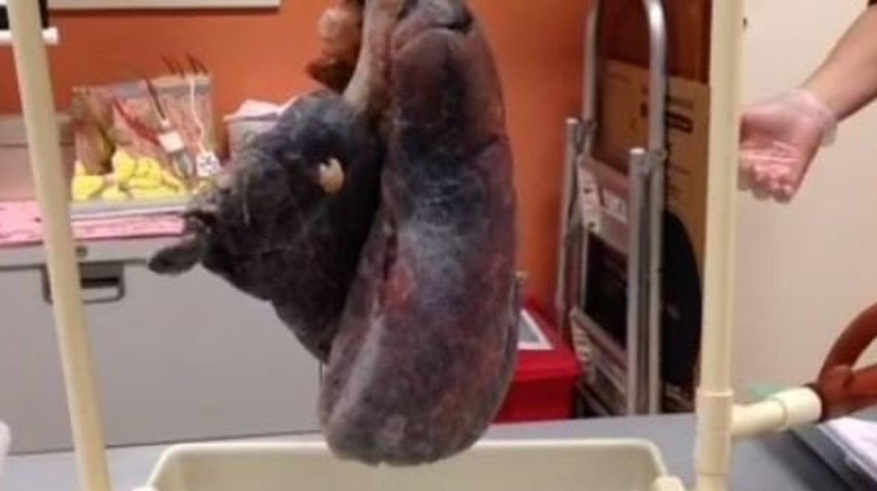 Cette Video De Poumon Presente Comme Celui D Un Fumeur Va Vous Laisser Sans Voix Le Huffington Post Life Cette Video De Poumon Presente Comme Celui D Un Fumeur Va Vous Laisser Sans Voix Le Huffington Post Life