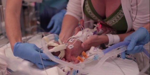 Video La Premiere Annee De Vie D Un Bebe Premature De 700 Grammes Emeut Le Web Le Huffpost