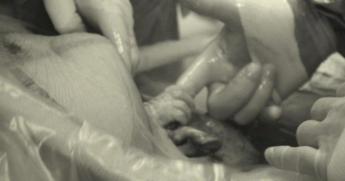 Un Bebe Saisit Le Doigt D Un Chirurgien Pendant Une Cesarienne La Photo Qui Fait Le Buzz Sur Internet Le Huffpost