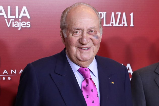 Juan Carlos I reaparece en público con un gran moratón en el