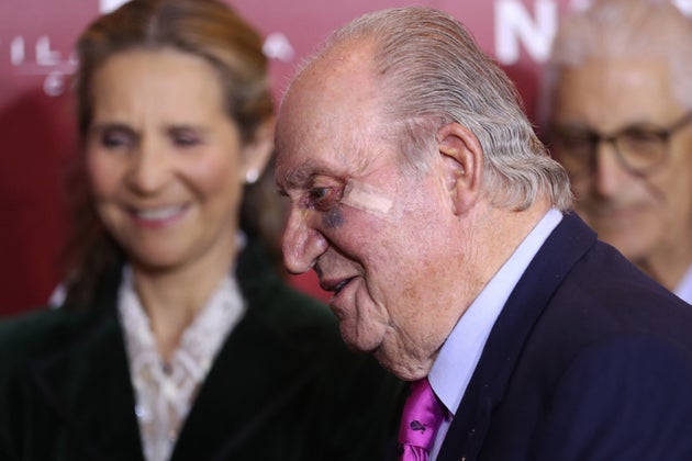 Juan Carlos I reaparece en público con un gran moratón en el