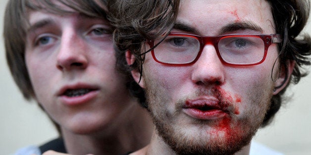 A gay rights activist is seen after clashes with anti-gay demonstrators during a gay pride event in St. Petersburg on June 29, 2013. Russian police arrested dozens of people on Saturday after clashes erupted in the city of Saint Petersburg between pro- and anti-gay demonstrators. AFP PHOTO / OLGA MALTSEVA (Photo credit should read OLGA MALTSEVA/AFP/Getty Images)