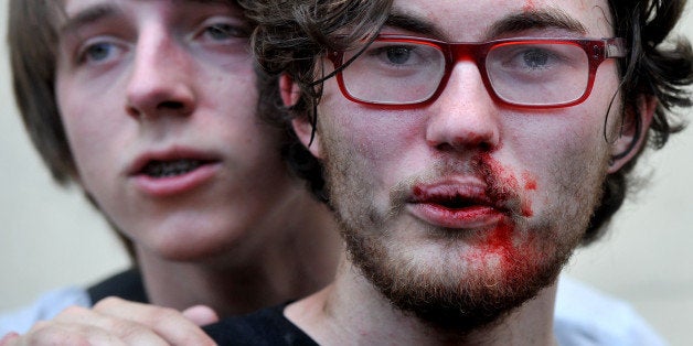A gay rights activist is seen after clashes with anti-gay demonstrators during a gay pride event in St. Petersburg on June 29