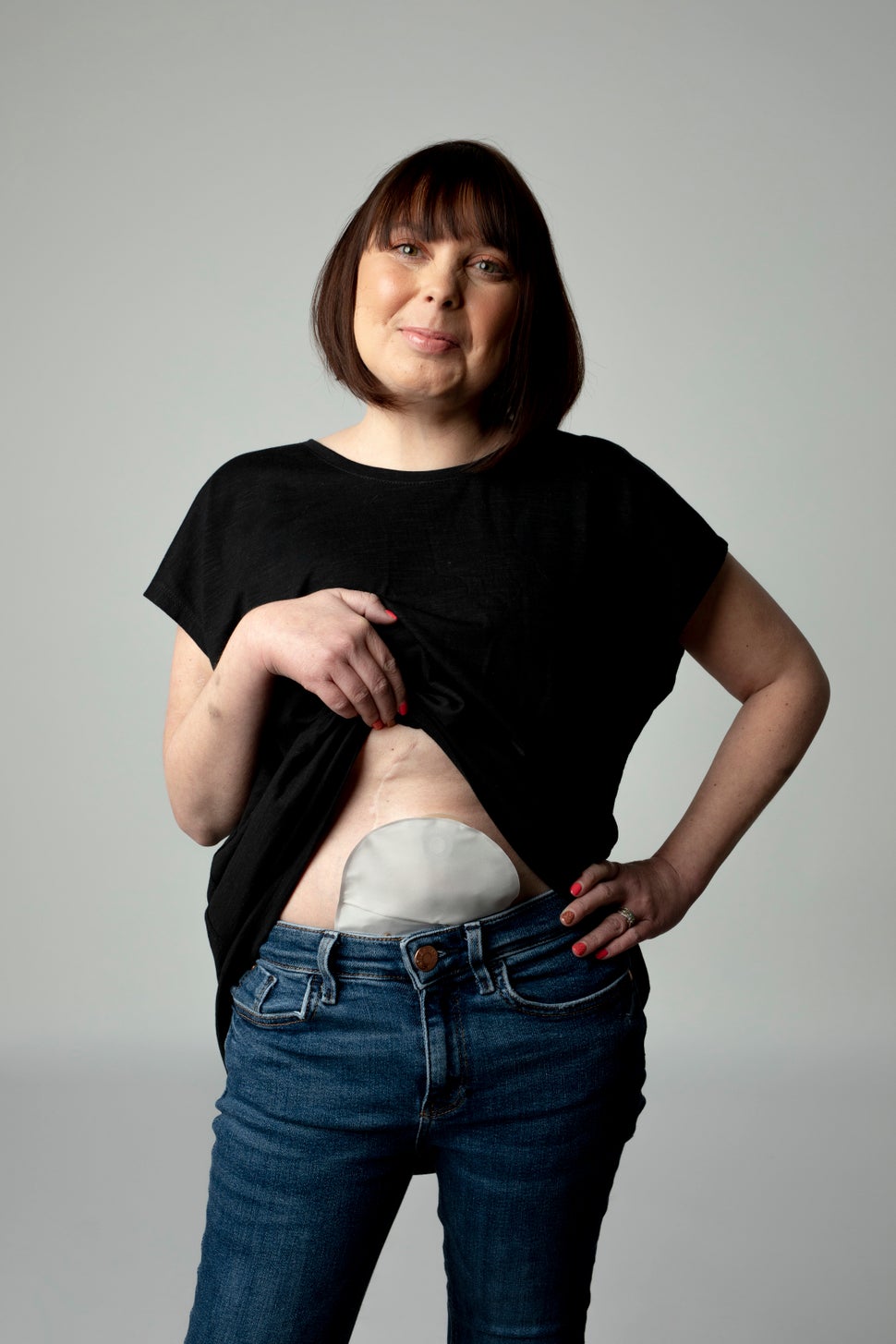 Deborah James Leads Powerful Photo Series Showing Bowel Cancer Doesn't