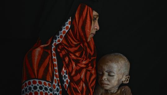 Πώς είναι να 'σαι μητέρα στην Υεμένη. Εκεί που «τα παιδιά πέφτουν σαν τα φύλλα» από το λιμό και τις