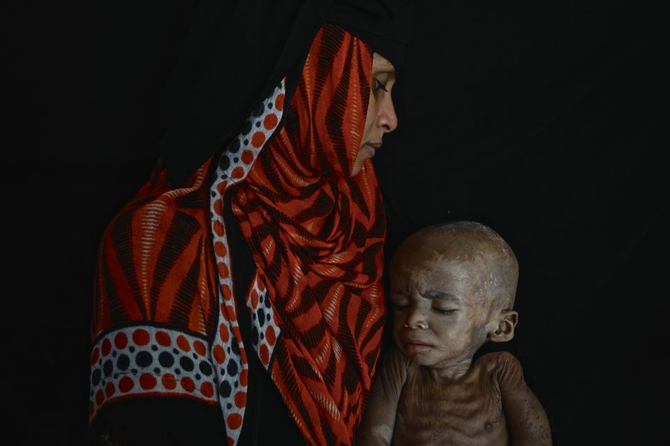 Πώς είναι να είσαι μητέρα στην Υεμένη. Εκεί που «τα παιδιά πέφτουν σαν τα φύλλα» από τον λιμό και τις