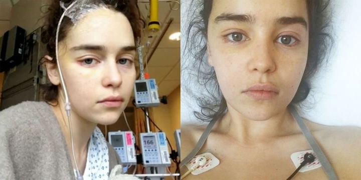 Atteinte en février 2011 d'une hémorragie méningée, un type mortel d'accident vasculaire cérébral, Emilia Clarke de Game of Thrones est transportée en urgence à l'Hôpital National de neurologie et de neurochirurgie de Londres.