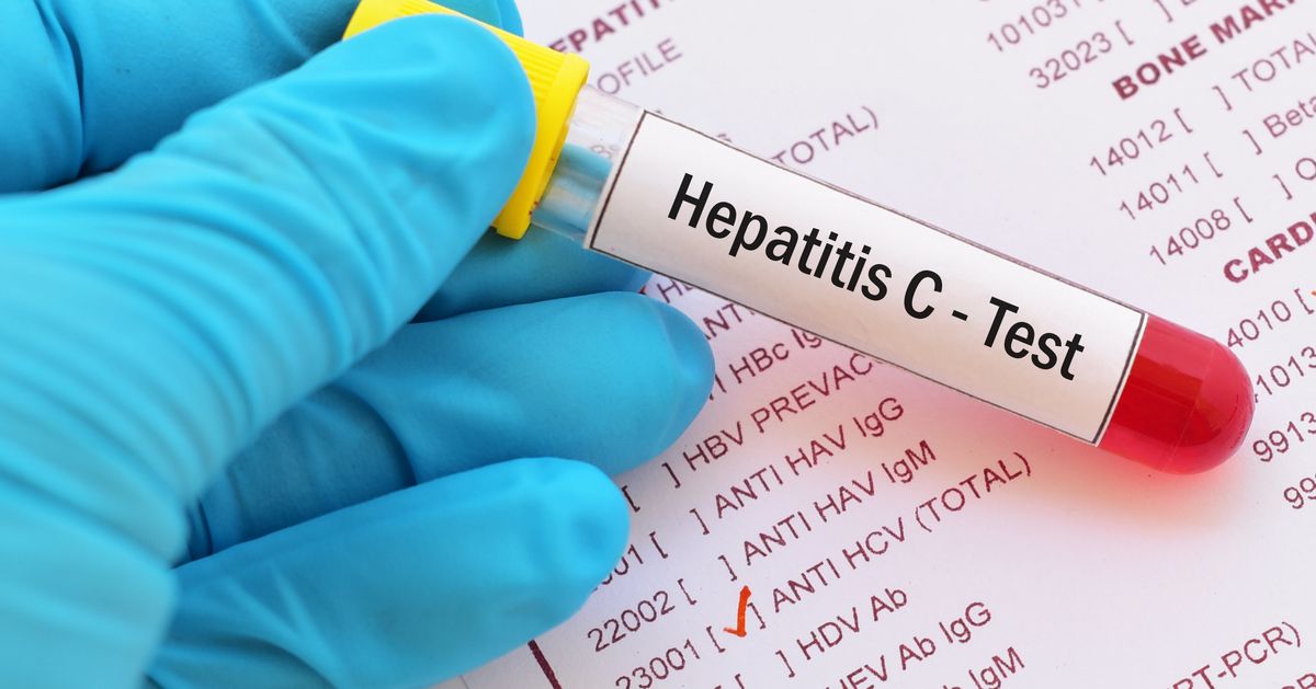 Тест болезни крови. Hepatitis c. Hepatit c Test. Вирусный гепатит HBV пробирка.