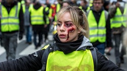 L’Ordre des médecins saisit la CNIL sur un “fichage” des gilets jaunes