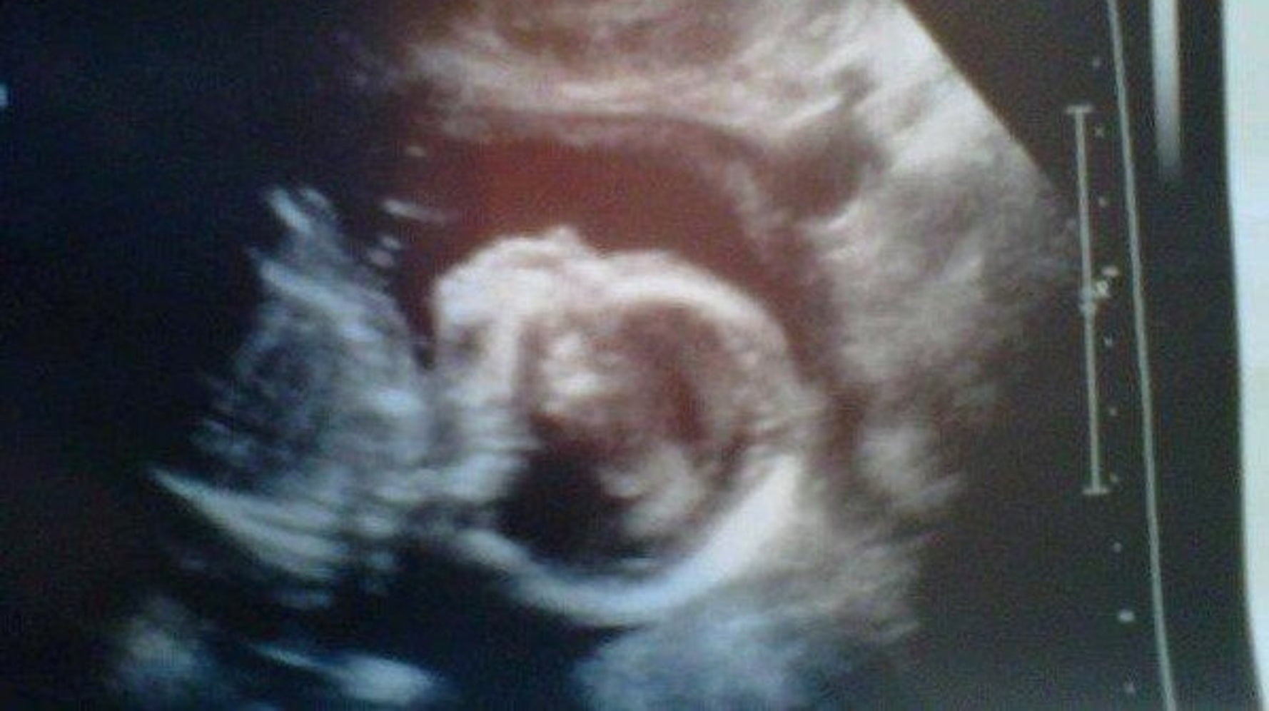 Mi Aborto En La Semana Me Enseno Todo Lo Necesario Sobre Ser Madre El Huffpost Mi Aborto En La Semana Me Enseno Todo Lo Necesario Sobre Ser Madre El Huffpost
