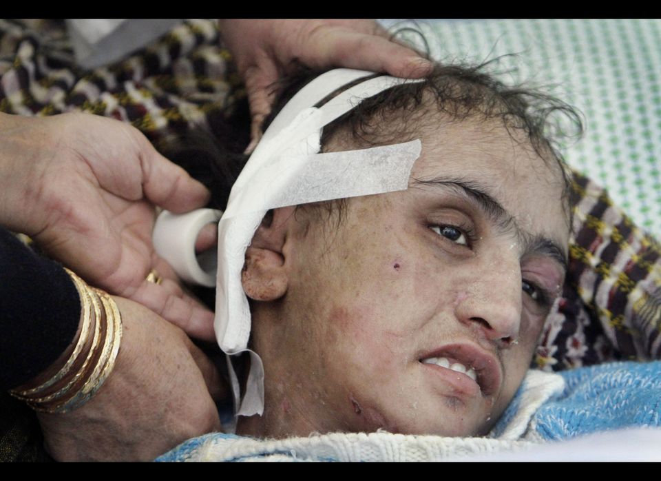 Afghanistan Tortured Girl