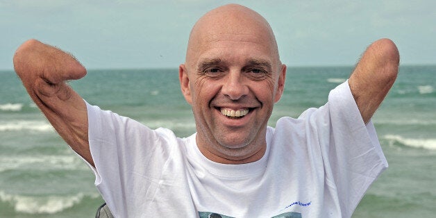 French amputee and swimmer Philippe Croizon poses on September 20, 2010 in Wissant, northern France after he succeeded on September 18 his attempt to swim the English Channel, a challenge he has been preparing for two years. Philippe Croizon, a 42-year-old former metalworker swam across the Channel 16 years after losing all his limbs in an electrical accident. AFP PHOTO PHILIPPE HUGUEN (Photo credit should read PHILIPPE HUGUEN/AFP/Getty Images)