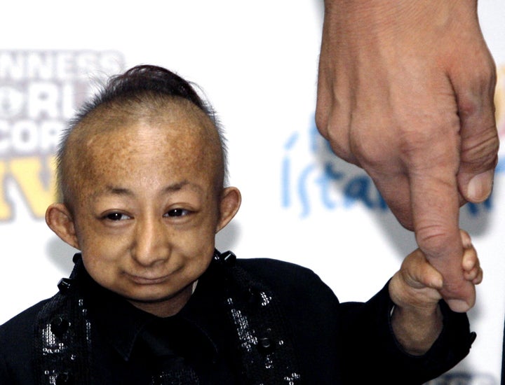 World's Shortest Man Dead: He Pingping Dies At 21 (PHOTOS)