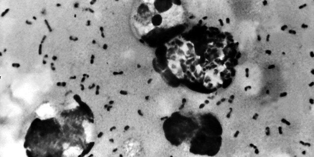 UNDATED PHOTO: A bubonic plague smear, prepared from a lymph removed from an adenopathic lymph node, or bubo, of a plague patient, demonstrates the presence of the Yersinia pestis bacteria that causes the plague in this undated photo. The FBI has confirmed that about 30 vials that may contain bacteria that could cause bubonic or pneumonic plague have gone missing, then found, from the Health Sciences Center at Texas Tech University January 15, 2003 in Lubbock, Texas. The plague, considered a likely bioterror agent since it's easy to make, is easily treatable with antibiotics if diagnosed early and properly. (Photo by Centers for Disease Control and Prevention/Getty Images)