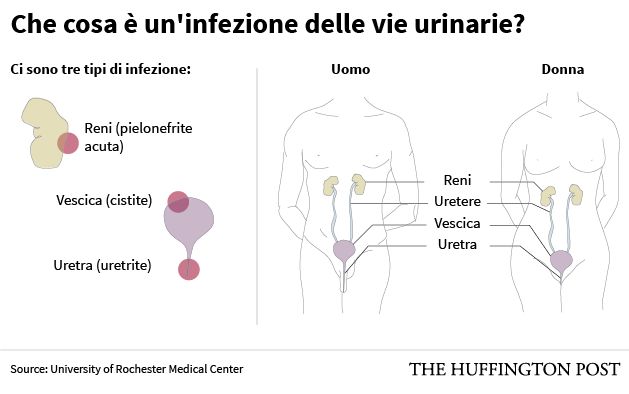 Tutto Quello Che Avreste Sempre Voluto Sapere Sulle Infezioni Del ...