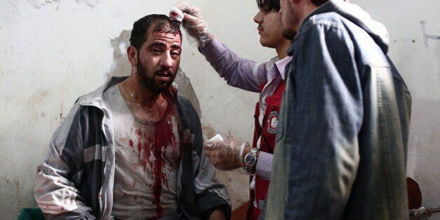 A wounded Syrian receives treatment at a makeshift hospital following a reported regime air raid in the besieged rebel bastion of Douma, northeast of the Syrian capital Damascus, on October 20, 2014. Closing in on Douma, a town of 200,000 residents, the army has seized control of Mleiha and Adra and has set its sights on Jobar and Ain Tarma, all towns to the east of the capital. AFP PHOTO/ ABD DOUMANY (Photo credit should read ABD DOUMANY/AFP/Getty Images)