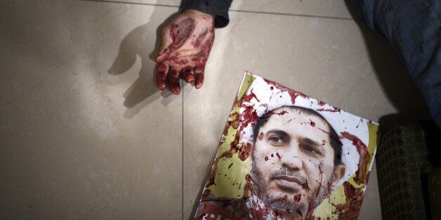 A Bahraini protester lies in a house after being wounded in clashes with riot police following a demonstration against the arrest of Sheikh Ali Salman (on the poster), head of the Shiite opposition movement al-Wefaq, in Salman's home village of Bilad al-Qadeem, on the outskirts of the capital Manama on January 20, 2015. The December 28 arrest of Salman, who heads the influential Al-Wefaq bloc, has prompted calls by the United States and Shiite-dominated Iran for his release as well as clashes between police and protesters in the Sunni-ruled kingdom. AFP PHOTO/MOHAMMED AL-SHAIKH (Photo credit should read MOHAMMED AL-SHAIKH/AFP/Getty Images)