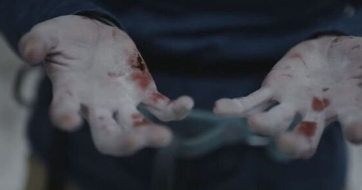 Sangue Dal Sedere Mal Di Pancia