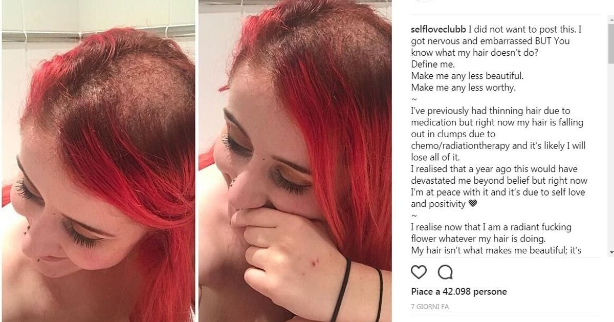 I Capelli Sono Semplicemente Capelli Non Ti Definiscono Milly Affetta Da Cancro Cervicale Ha Un Messaggio Per Tutti L Huffpost