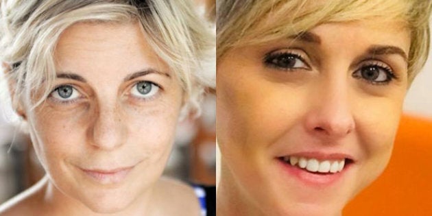 Nadia Come La Mia Wondy Sa Che Il Tumore Non E Un Dono L Opportunita Di Non Farsi Disintegrare E Il Loro Vero Messaggio L Huffpost