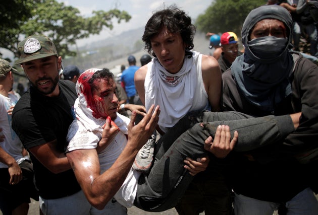 A demonstrator wounded in the clashes with government