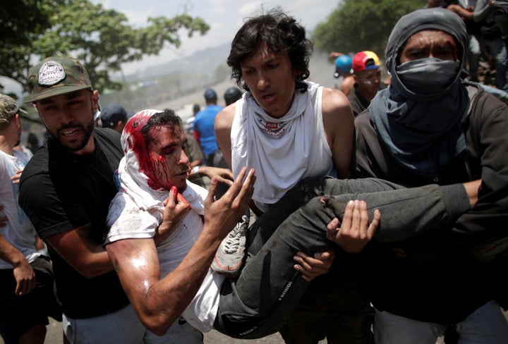 A demonstrator wounded in the clashes with government forces.