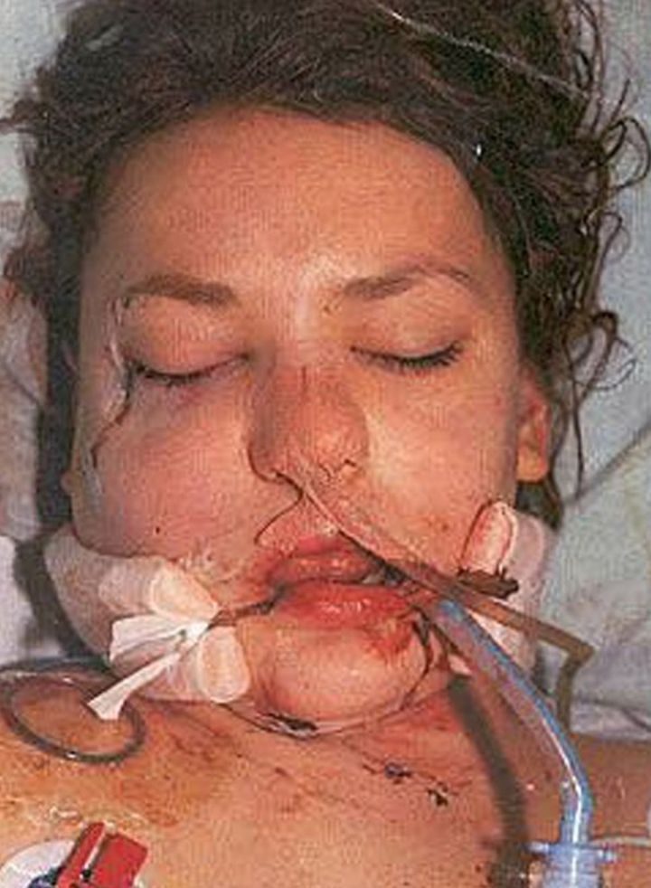 Jessica Knight when she was in hospital at the age of 14
