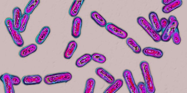 Clostridium difficile (bacteria responsible for hospital acquired diarrhoea) seen under optical microscopy. (Photo by: BSIP/UIG via Getty Images)