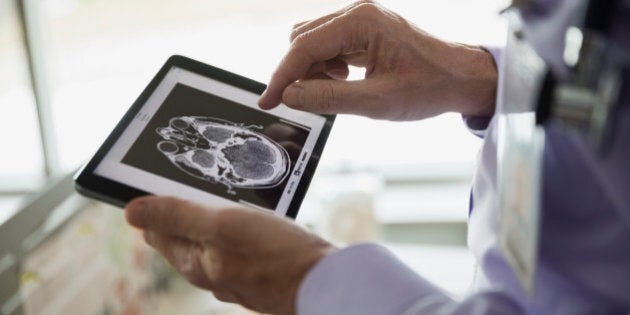 Doctor examining CT scan on digital tablet