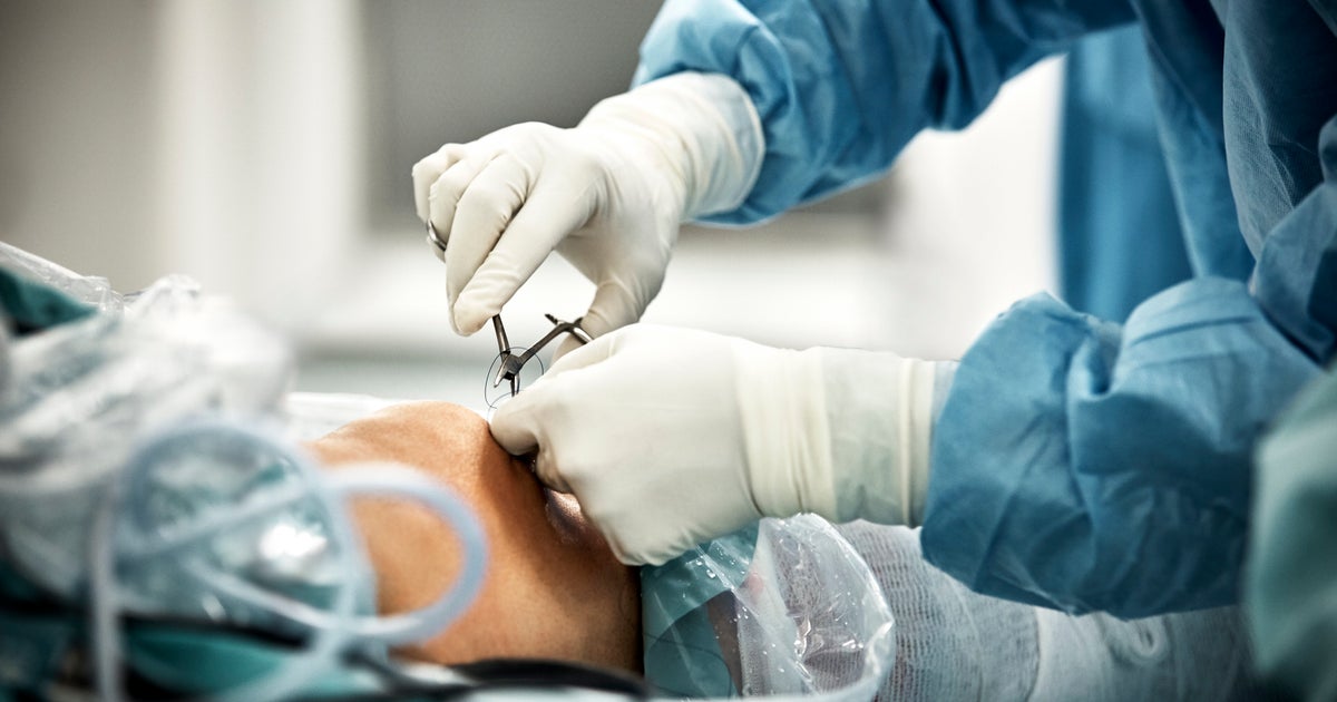 Classement Des Meilleurs Chirurgiens Orthopediques Genou 2022 Cette commune opération du genou est peu bénéfique, selon des