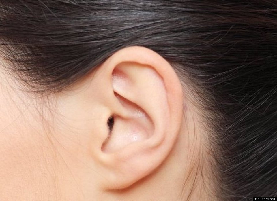 Etes Vous Allergique Au Soleil Quelques Symptomes Qui Mettent La Puce A L Oreille Huffpost Quebec Vivre Etes Vous Allergique Au Soleil Quelques Symptomes Qui Mettent La Puce A L Oreille Huffpost Quebec Vivre