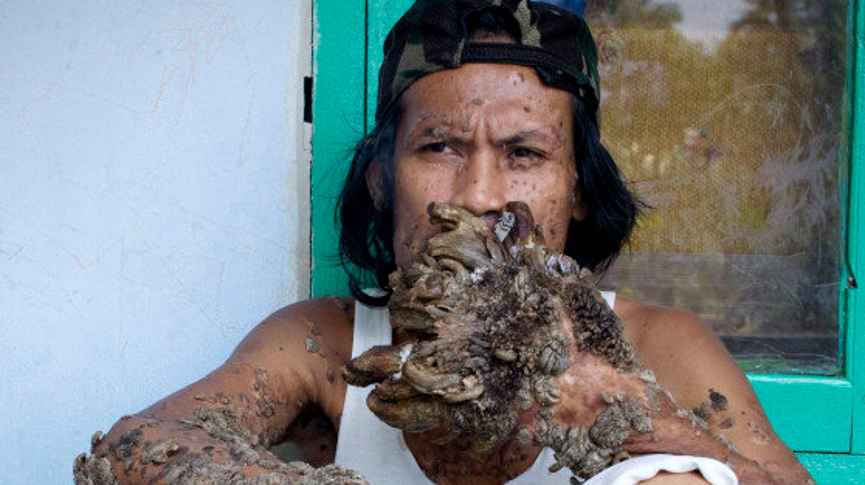 Dede Koswara (Tree Man) Wikipedia T-Shirt, image size:1778x997