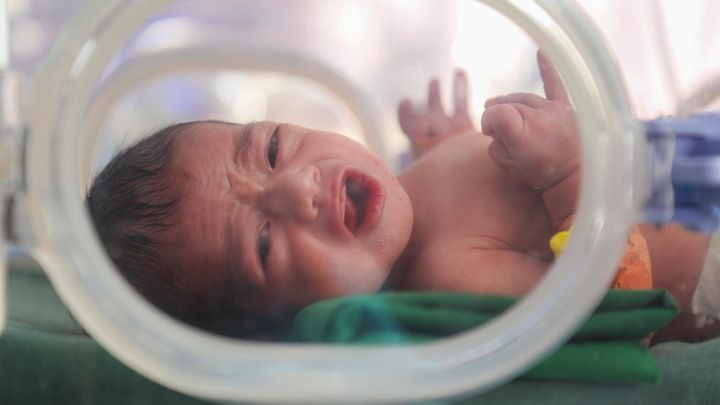 Le 8 janvier 2018 : Un nourrisson né prématurément reçoit un traitement à l'hôpital Alsabeen de Sanaa, au Yémen.